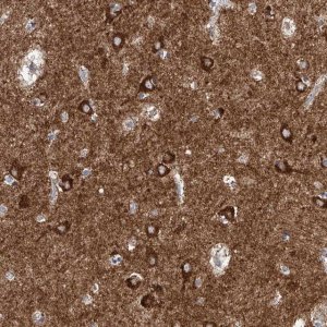Anti-CPNE5 antibody produced in rabbit 
