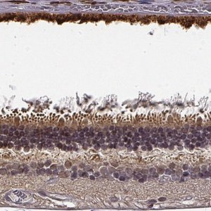 Anti-CRB1 antibody produced in rabbit 