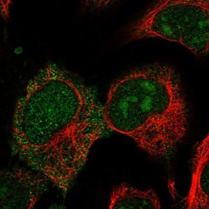 Anti-CRIP2 antibody produced in rabbit 