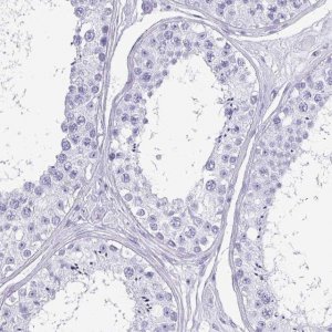 Anti-CRYBB2 antibody produced in rabbit 