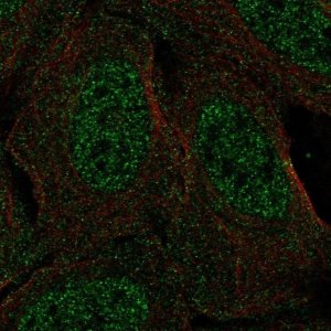 Anti-CSDC2 antibody produced in rabbit 