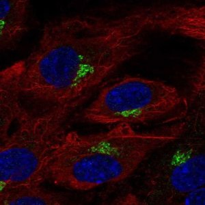 Anti-CSF2RB antibody produced in rabbit 