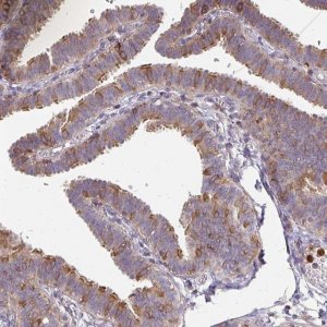 Anti-CSF3R antibody produced in rabbit 