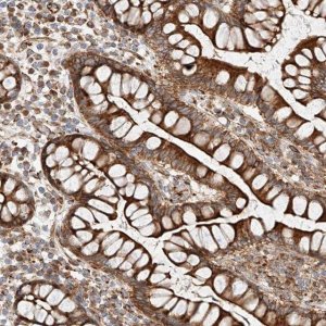 Anti-CSGALNACT2 antibody produced in rabbit 