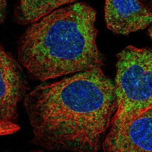 Anti-CSGALNACT2 antibody produced in rabbit 