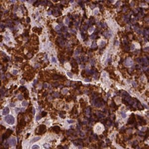 Anti-CSH1 antibody produced in rabbit 