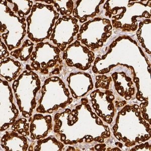 Anti-CSN2 antibody produced in rabbit 