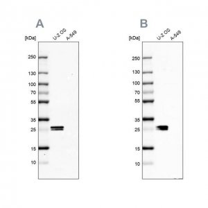 Anti-CT45A1 antibody produced in rabbit HPA046872-100UL