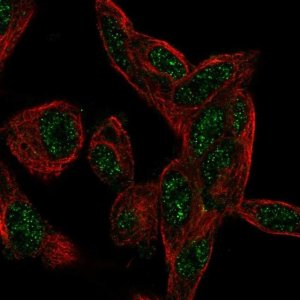 Anti-CTDSP1 antibody produced in rabbit 