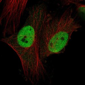 Anti-CTDSPL2 antibody produced in rabbit 
