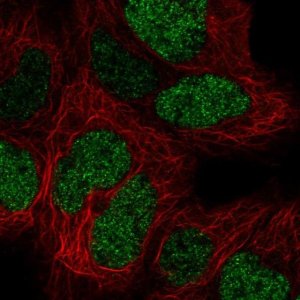 Anti-CTR9 antibody produced in rabbit 
