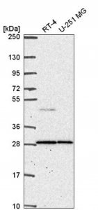 Anti-CTSC antibody produced in rabbit 
