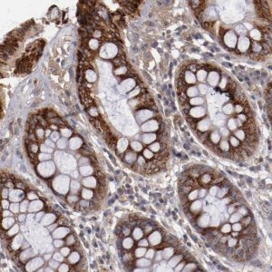 Anti-CXorf36 antibody produced in rabbit 