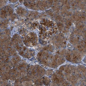 Anti-CYB5D1 antibody produced in rabbit 
