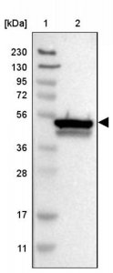 Anti-CYB5R4 antibody produced in rabbit HPA018992-100UL