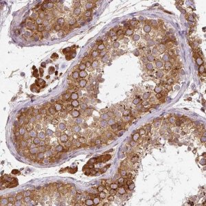 Anti-CYP20A1 antibody produced in rabbit 