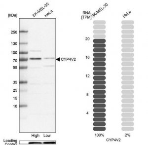 Anti-CYP4V2 antibody produced in rabbit 