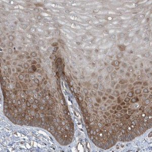 Anti-CYR61 antibody produced in rabbit 