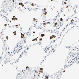 Anti-CYSLTR1 antibody produced in rabbit HPA010546-100UL