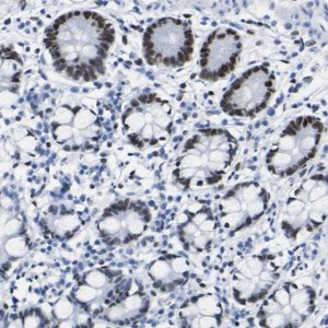 Anti-DACH1 antibody produced in rabbit 