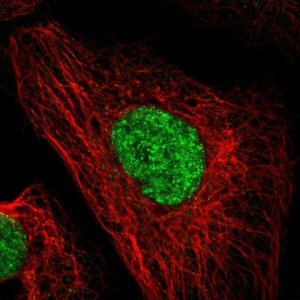 Anti-DACH1 antibody produced in rabbit 