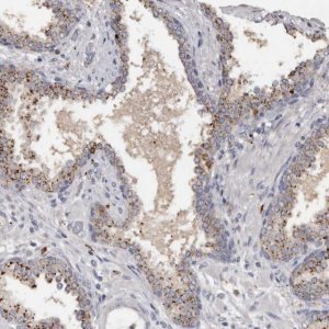 Anti-DAP antibody produced in rabbit 