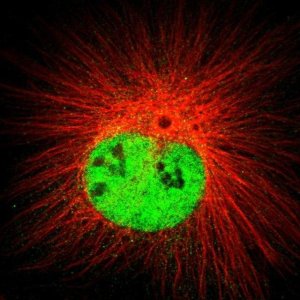 Anti-DCAF11 antibody produced in rabbit 