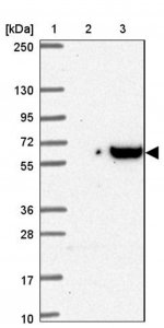 Anti-DCBLD1 antibody produced in rabbit 