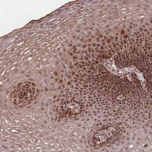 Anti-DCHS1 antibody produced in rabbit 