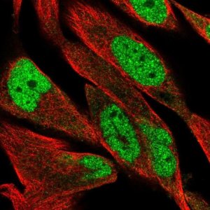 Anti-DCLRE1B antibody produced in rabbit 