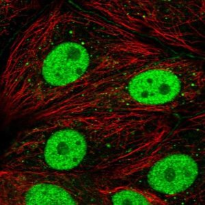 Anti-DCP2 antibody produced in rabbit 