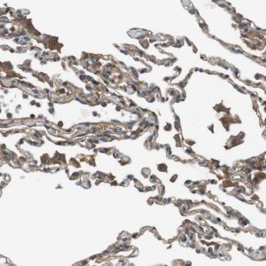 Anti-DDAH2 antibody produced in rabbit HPA012509-100UL