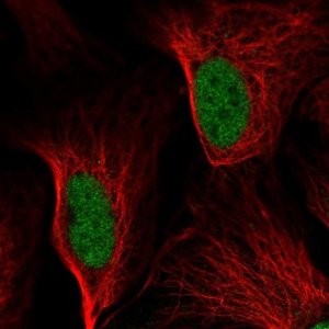 Anti-DDIT3 antibody produced in rabbit 