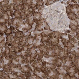 Anti-DDIT4 antibody produced in rabbit 