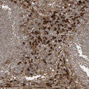 Anti-DDIT4 antibody produced in rabbit 