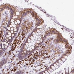 Anti-DDOST antibody produced in rabbit 