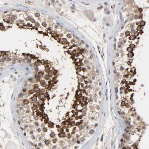 Anti-DDX10 antibody produced in rabbit 