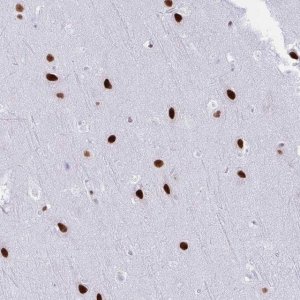 Anti-DDX52 antibody produced in rabbit 