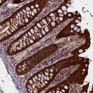 Anti-DENND1B antibody produced in rabbit 