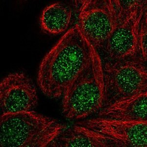 Anti-DENND2C antibody produced in rabbit 