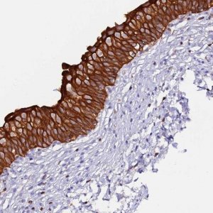 Anti-DENND2D antibody produced in rabbit HPA043630-100UL
