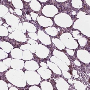 Anti-DENND4A antibody produced in rabbit 