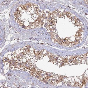 Anti-DENND5B antibody produced in rabbit 