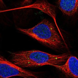 Anti-DENND6A antibody produced in rabbit 