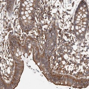 Anti-DENND6B antibody produced in rabbit 