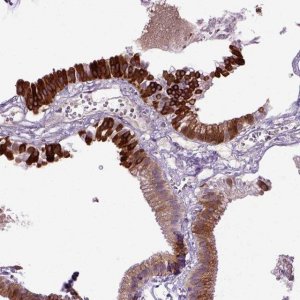 Anti-DEPDC1B antibody produced in rabbit HPA072558-100UL