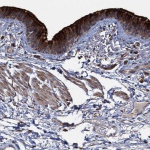 Anti-DEPDC4 antibody produced in rabbit 