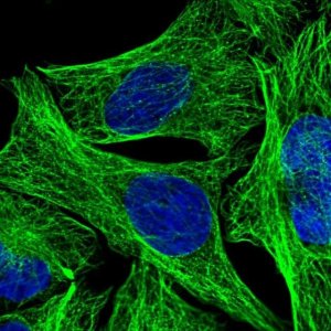 Anti-DEPDC4 antibody produced in rabbit 