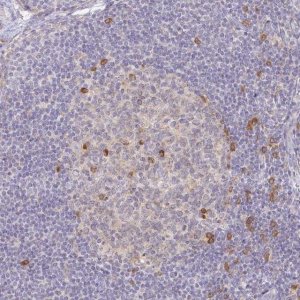 Anti-DERL2 antibody produced in rabbit 