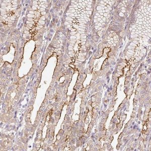Anti-DESI1 antibody produced in rabbit 